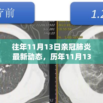 歷年11月13日新冠肺炎動(dòng)態(tài)回顧，最新進(jìn)展、當(dāng)前動(dòng)態(tài)與未來(lái)展望