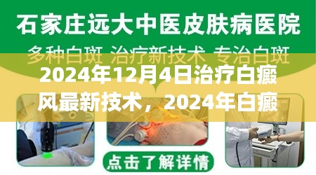 2024年白癜風治療最新技術(shù)解讀與應用前景展望，革新與未來趨勢