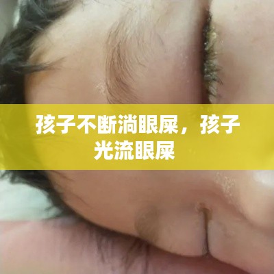 孩子不斷淌眼屎，孩子光流眼屎 