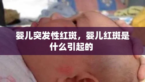 嬰兒突發(fā)性紅斑，嬰兒紅斑是什么引起的 