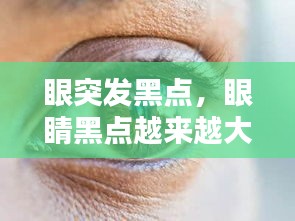 眼突發(fā)黑點(diǎn)，眼睛黑點(diǎn)越來越大 