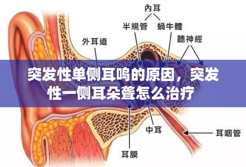 突發(fā)性單側(cè)耳鳴的原因，突發(fā)性一側(cè)耳朵聾怎么治療 